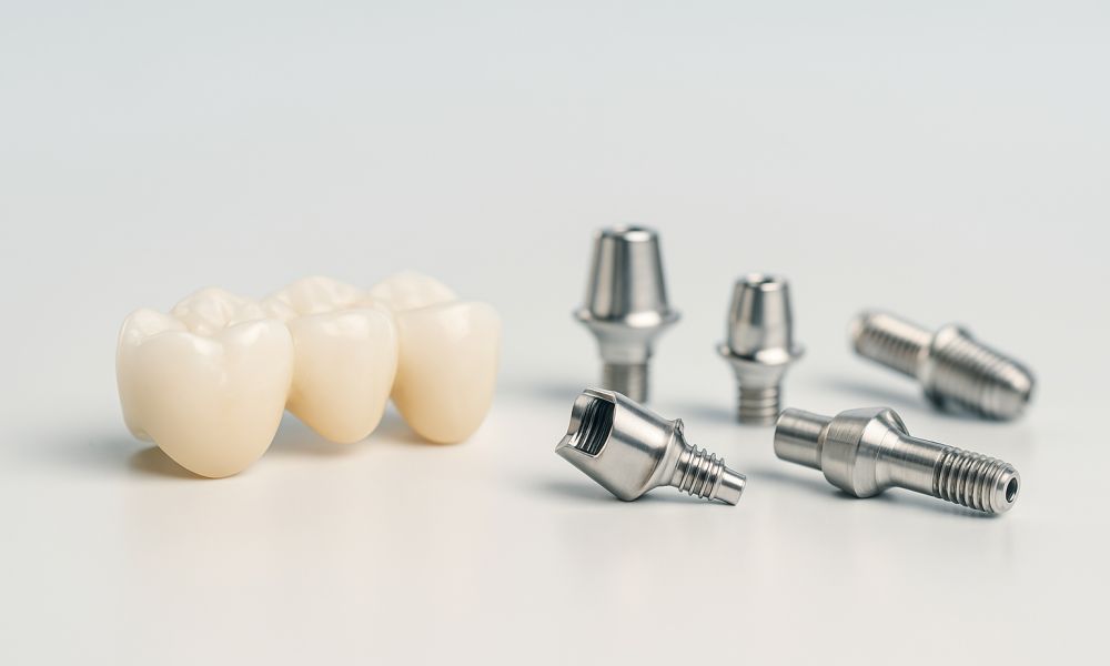 Prothetik-Bauteile für Kronen und Brücken bei Procon Medizintechnik